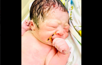 Failed contraception: Newborn baby clasps IUD after being born [a viral photo]