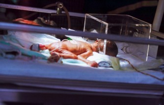 Premature Baby Born with Tumor Bigger than Her, Now Thriving [Parents Refused to Abort Her]