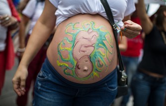 Uterus Didelphys: Arizona Woman With Two Vaginas, Two Uteruses Had Ectopic Pregnancy