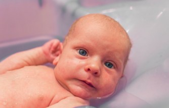 Aquaphor for Cradle Cap: A Parent’s Guide to Effective Treatment