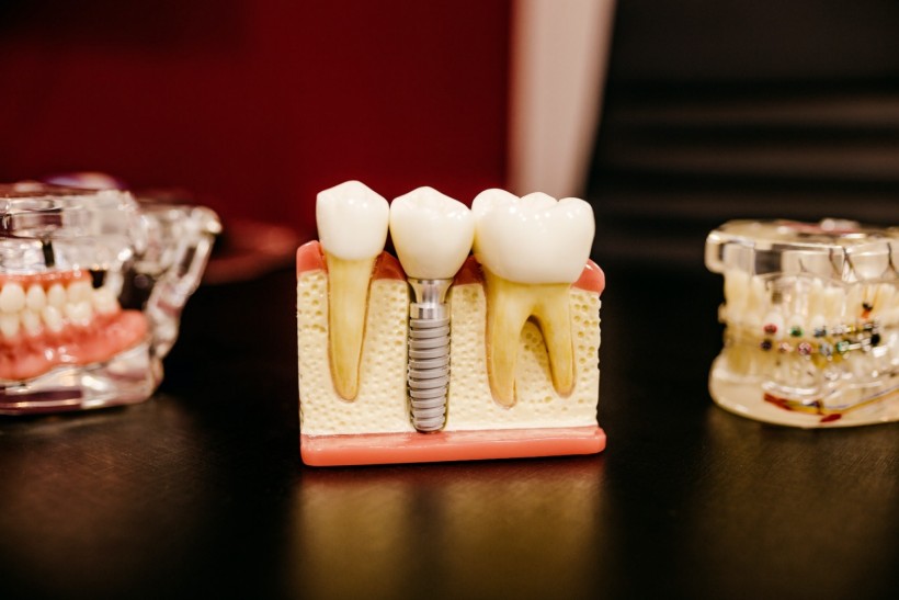 dentist, teeth, tooth and dental