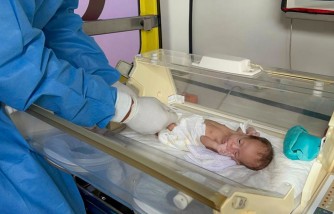 Twin Born Paper White While Other Baby Had Excess Red Blood Cells Due to Twin-to-Twin Transfusion Syndrome